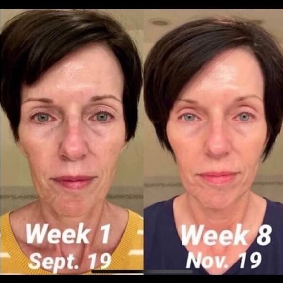 Mary Kay Clinical Solutions Set Retinol .5 and Calm Restore Face Milk New in Box - Picture 3 of 11